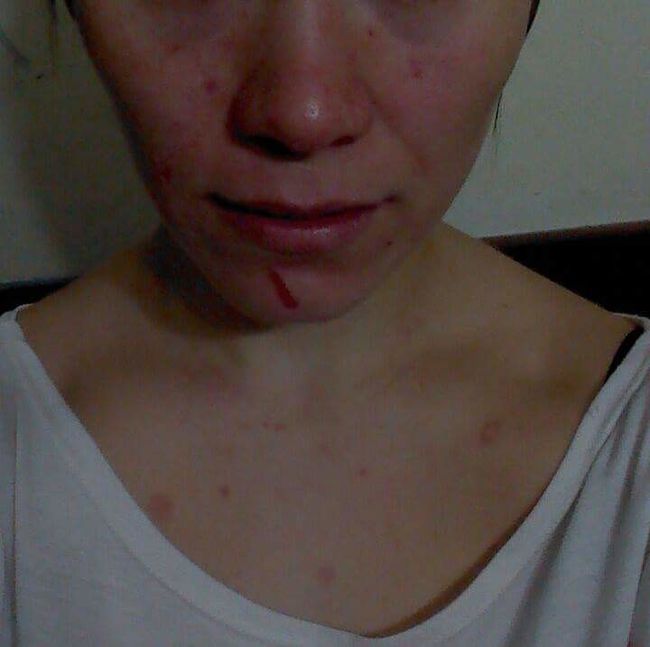 Joven golpeada por su ex: “Entró con intenciones de matarme”