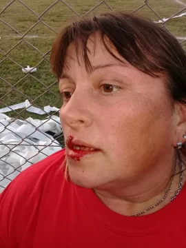 Una mujer de la subcomisión de fútbol fue agredida por un hincha