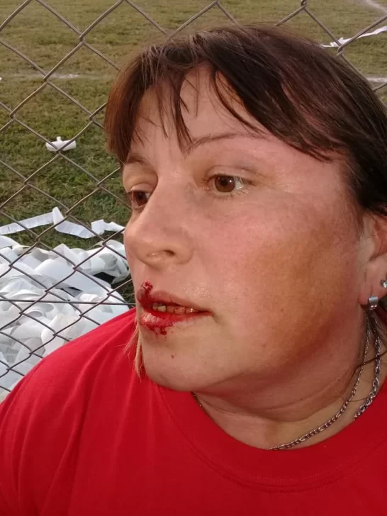 Una mujer de la subcomisión de fútbol fue agredida por un hincha