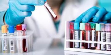 Las comunas sostendrán el costo de los análisis en el Hospital Meroi
