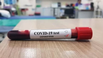 Diagnosticaron con covid-19 a una mujer y aislaron a su familia en Diaz