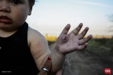 Vecinos denuncian a fábrica por contaminación y severos efectos en la salud