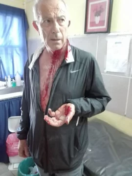 Palotti agredido: “Volvieron los patoteros de siempre”