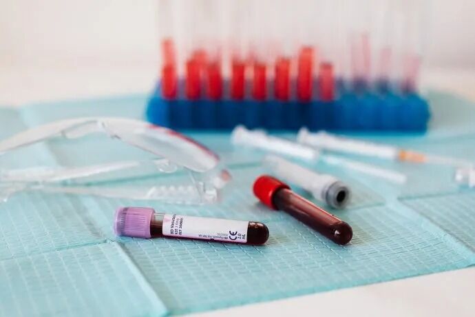 Abrió en Oliveros la tecnicatura en hemoterapia: Ya te podés inscribir